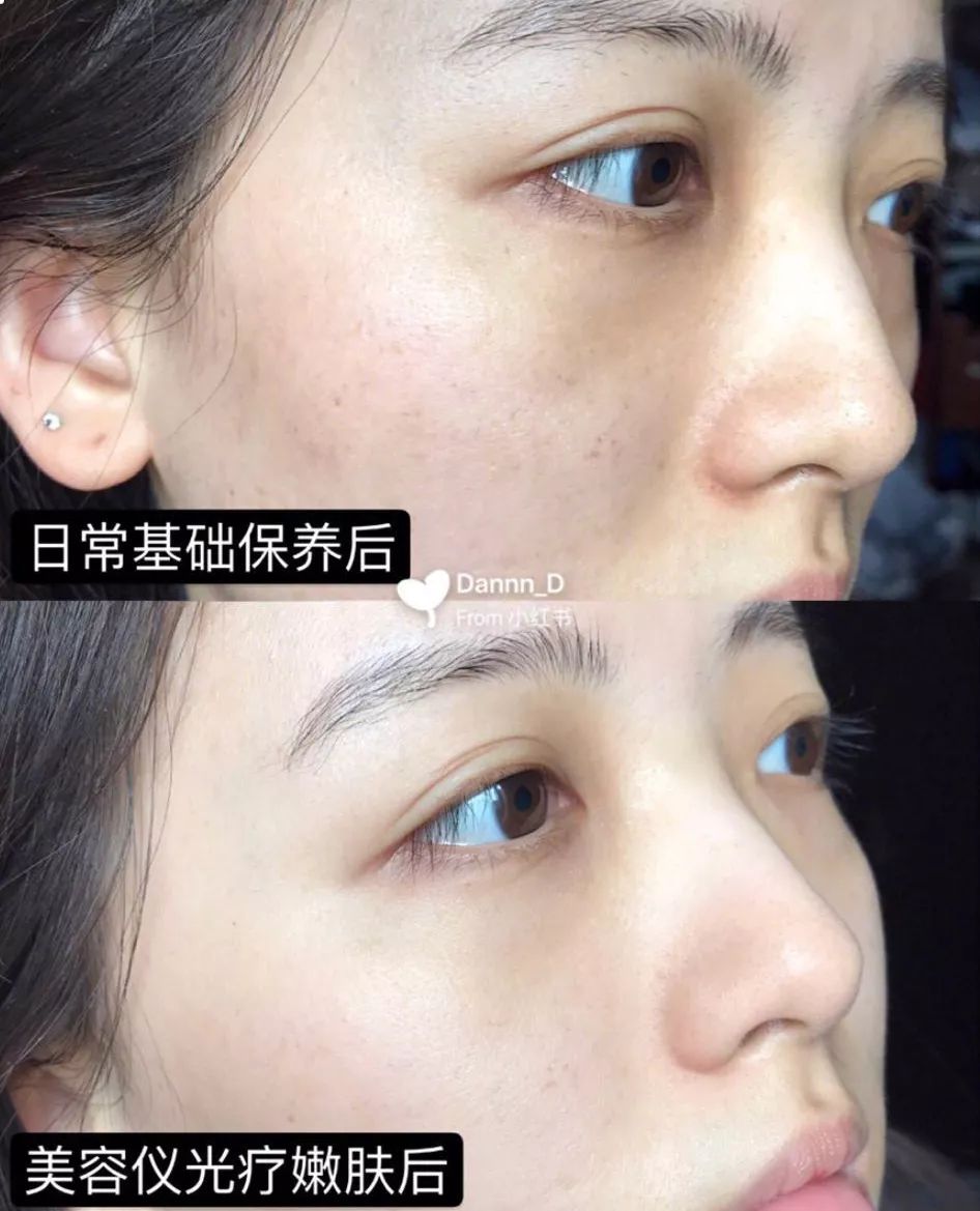 美容院的美容仪器需要投资多少钱,美容院哪些项目值得做仪器