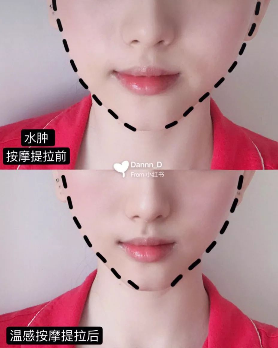 美容院的美容仪器需要投资多少钱,美容院哪些项目值得做仪器
