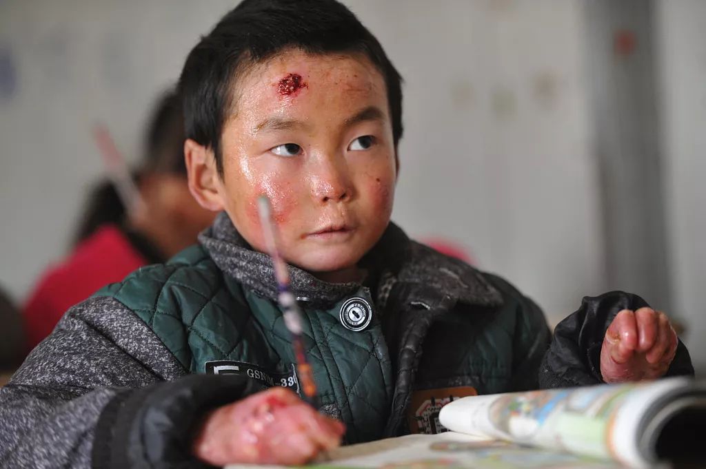 罕见病人自述经历,一个外科医生的自述