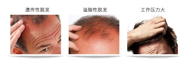 目前市面上比较靠谱的育发洗发水,德国育发洗发水