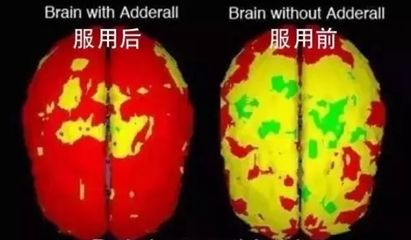 “聪明药”年销超80亿片！坑了无数美国高材生，现在正把魔爪伸向中国...