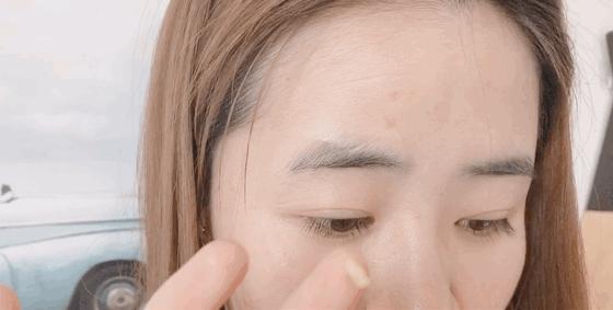 5个祛斑小妙招淡化晒斑雀斑痘印,痘印晒斑和疤痕用什么产品比较好