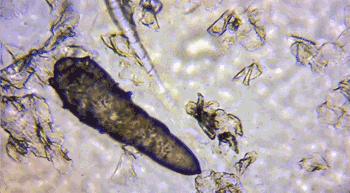 鼻头总是挤出白色丝条中医辨证,鼻头一挤就有白丝