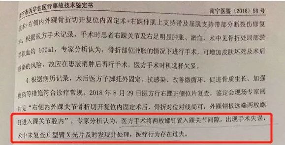 骨折手术后两个月去取钢钉,女子骨折2个月