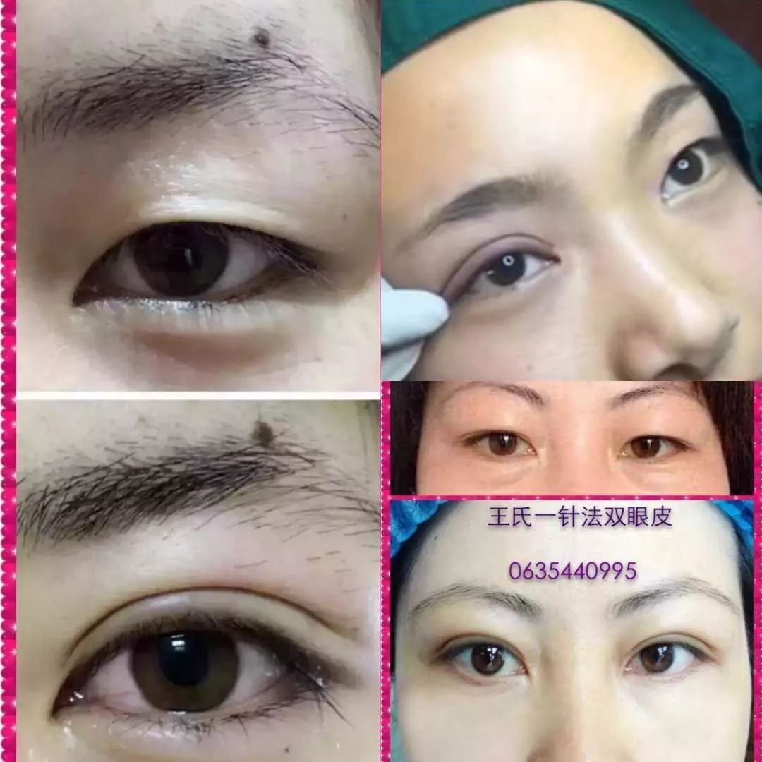 美容养生送泥灸福利,理疗养生福利