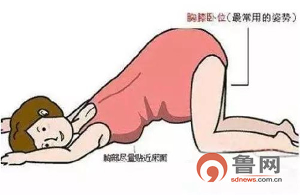 产妇突发羊水栓塞危急时刻,产妇脐带脱垂紧急抢救演练