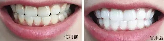 【3折抄底】身体清洁专场：进口、大牌、低至9.9包邮。喜欢干净漂亮的你～