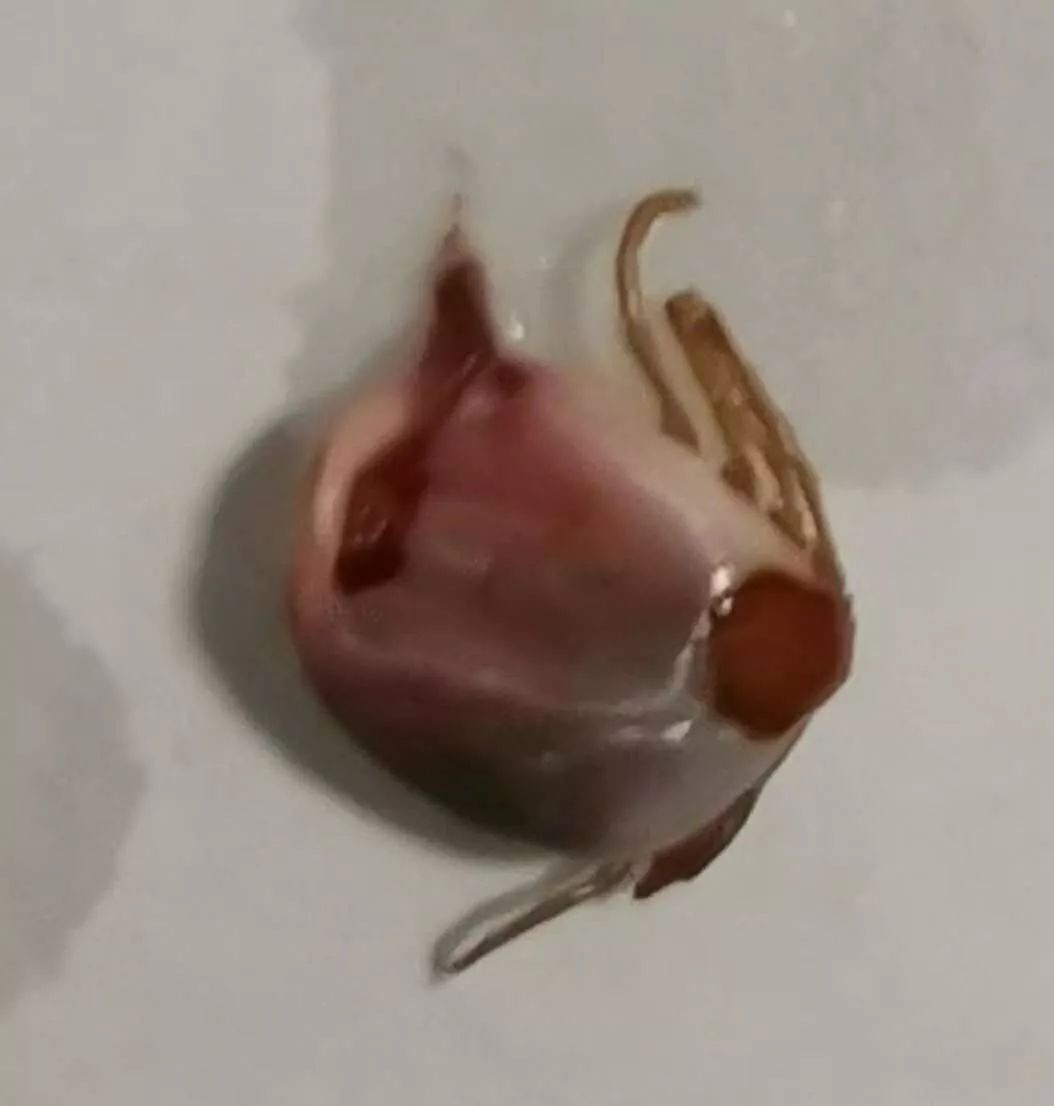 3岁女童头痒是什么原因,三岁孩子头皮有黄色结痂