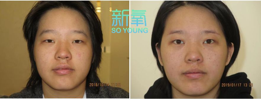 假小子变装惊艳全场的样子,肿眼泡假小子