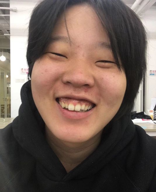 假小子变装惊艳全场的样子,肿眼泡假小子