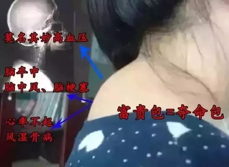 颈肩腰疼用什么热敷,颈肩腰痛小偏方