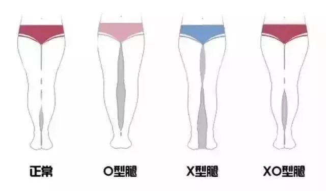 运动鞋鞋帮高度怎么选,穿运动鞋腿不好看