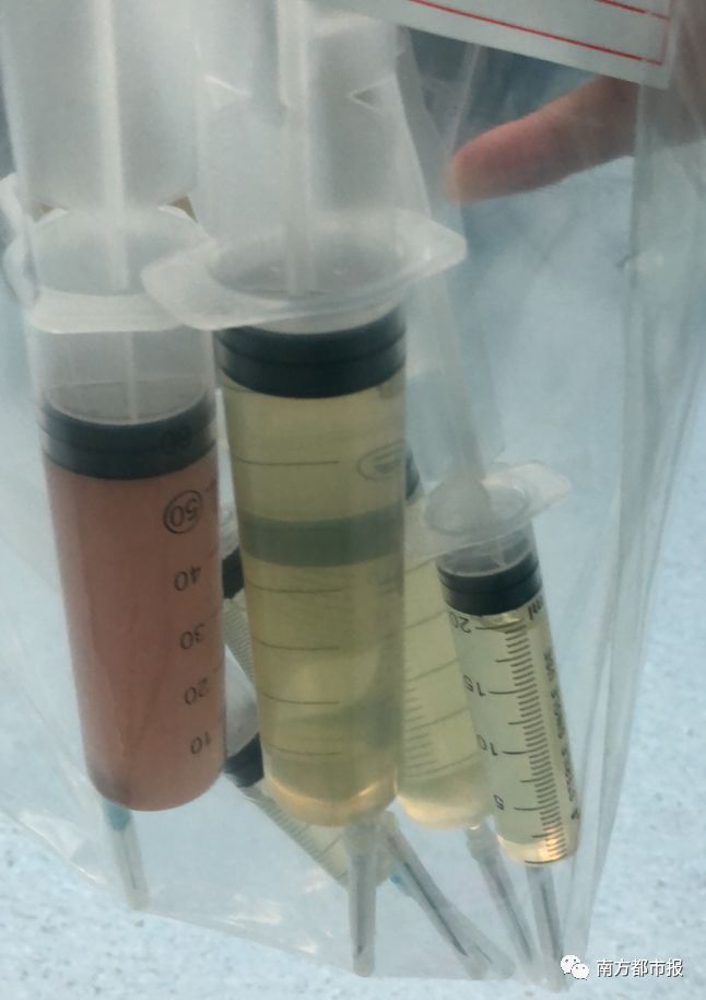 4岁娃肚大如孕妇，竟从体内抽出2斤寄生虫液！