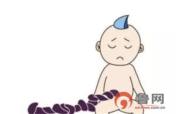 这个35+3周的宝宝出生时脐带扭成了麻花，且呈紫红色……