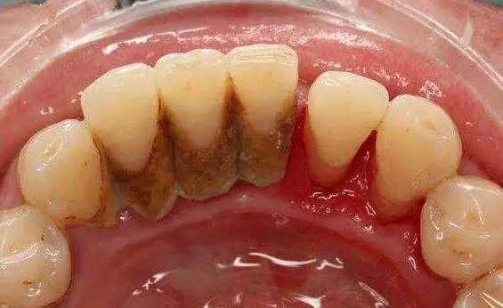 不到1折疯抢！全家口腔健康有保证~29.9元抢购原价895元劲松牙科家庭口腔护理套餐！超声波洁牙+中老年口腔护理+儿童口腔护理…