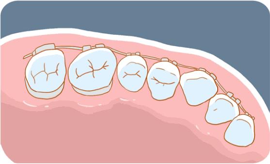 不到1折疯抢！全家口腔健康有保证~29.9元抢购原价895元劲松牙科家庭口腔护理套餐！超声波洁牙+中老年口腔护理+儿童口腔护理…