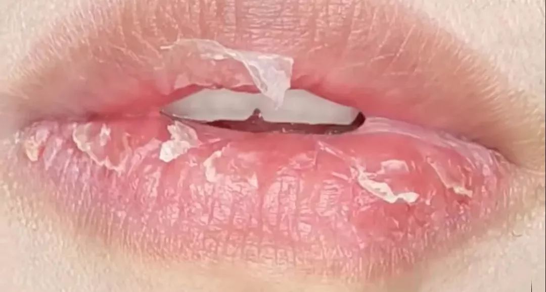 软化死皮淡化唇纹唇膜,唇霜去死皮淡化唇色