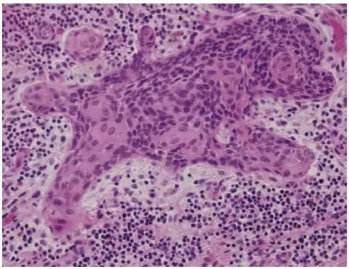 直到看了病理医生切的片子，我才明白了什么叫「艺术细胞」
