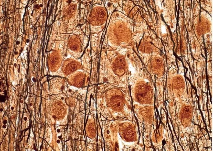 直到看了病理医生切的片子，我才明白了什么叫「艺术细胞」