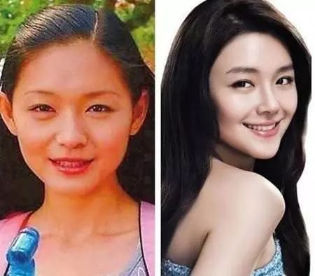 深扒美白成分不可不知的烟酰胺,高端美白针