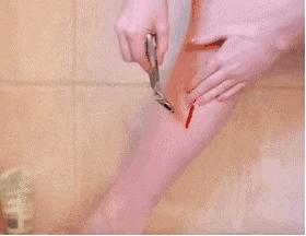 成都医美月▏现在不脱毛，夏季猕猴桃，你不脱毛？100%尴尬