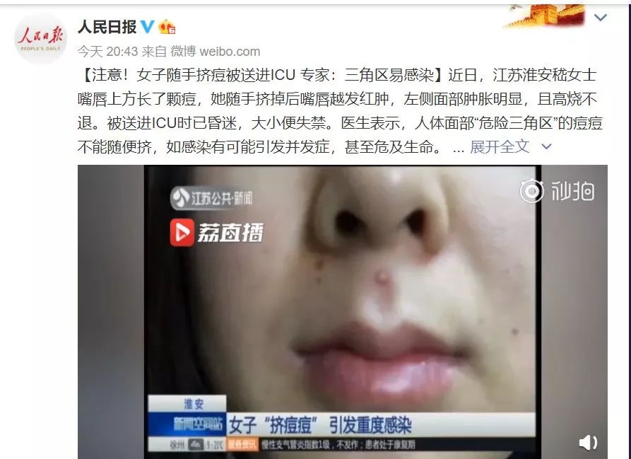 这个地方长痘千万别动！这起悲剧为所有人敲响警钟！