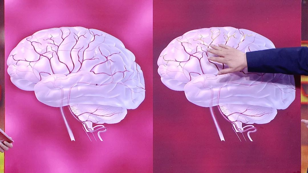 养生堂2023.11.7全集免费,养生堂2020全集视频直播