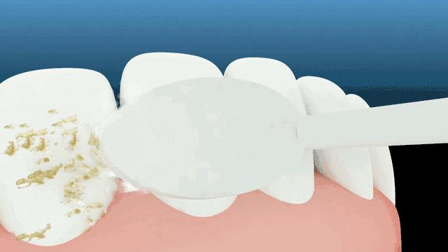 俄罗斯牙膏美白去口臭牙黄,去牙垢黄牙的牙膏测评