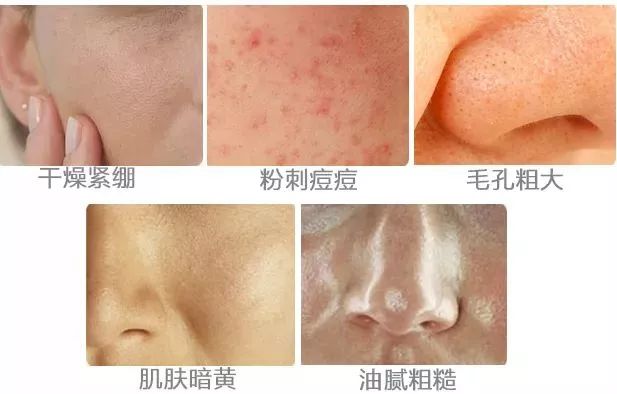 平价超级补水的护肤品,补水纯露国货好物推荐