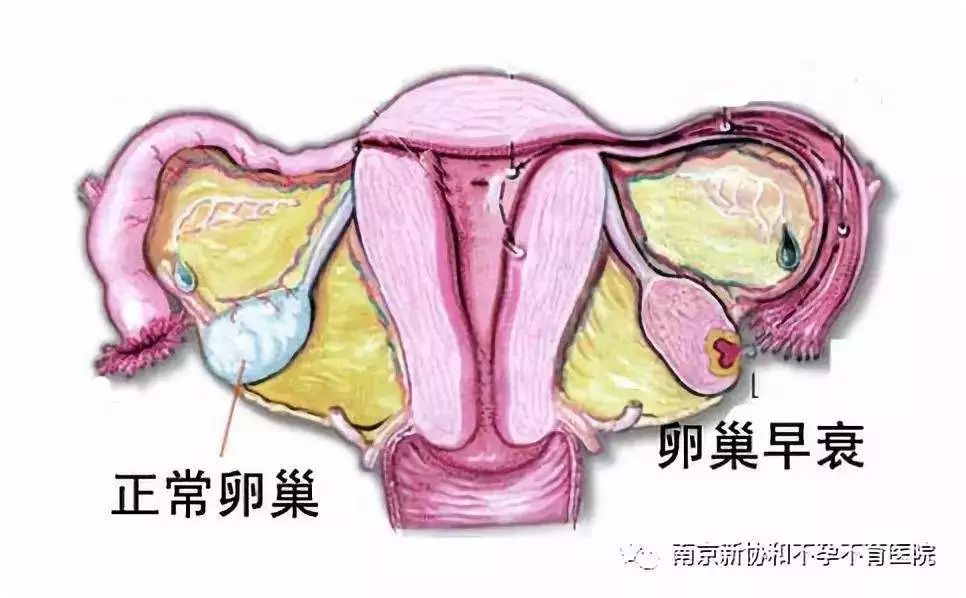 写给被我们割掉的子宫、扁桃体、胆囊、脾、卵巢、阑尾的祭文，割掉后果……
