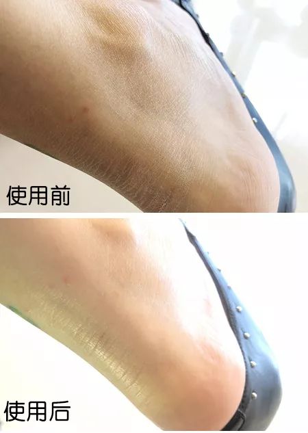 脚后跟套上这个“*钟金**罩”夏季穿鞋嫩到反光！干裂、老茧、死皮都没了！