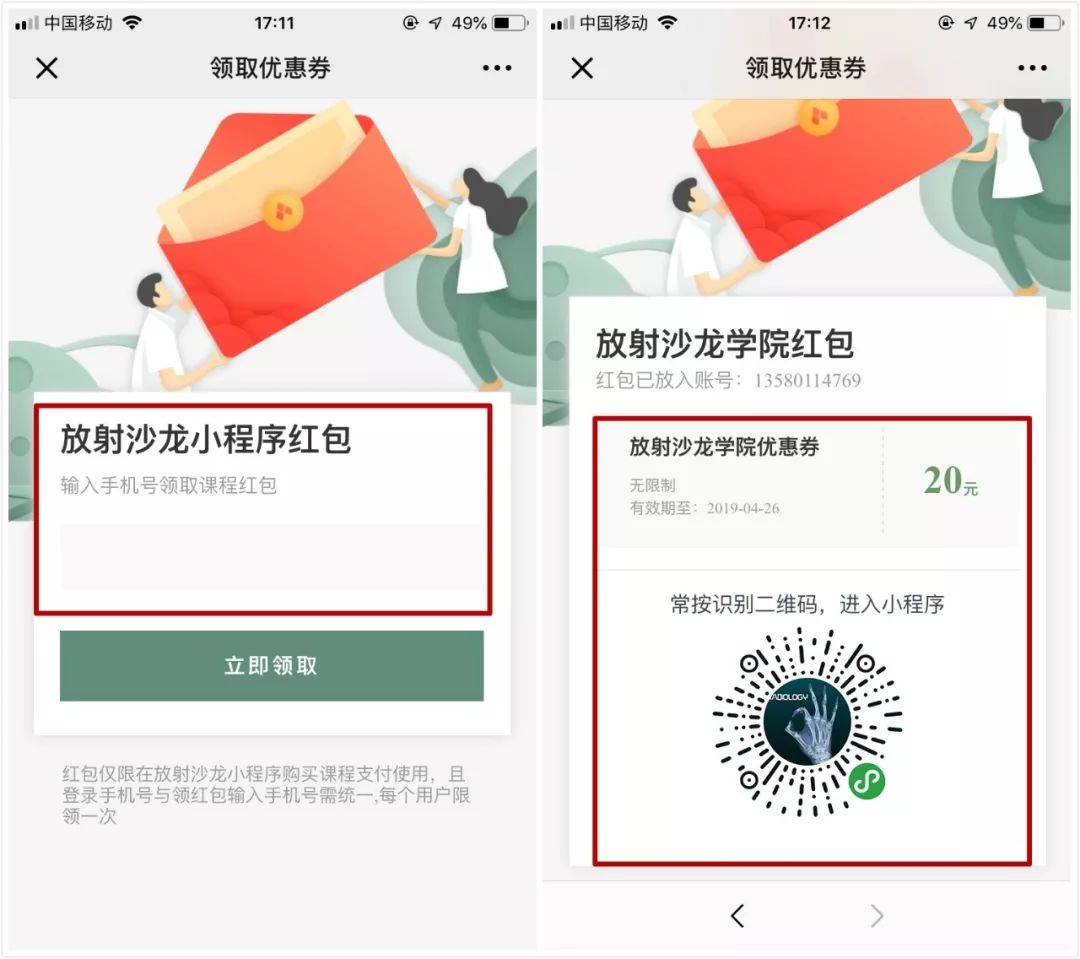肩关节脱位易漏诊的骨折,放射科容易漏诊的骨折