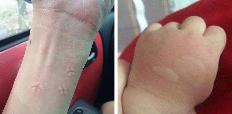 日本最好用的蚊虫膏 (日本变态蚊子膏价格)