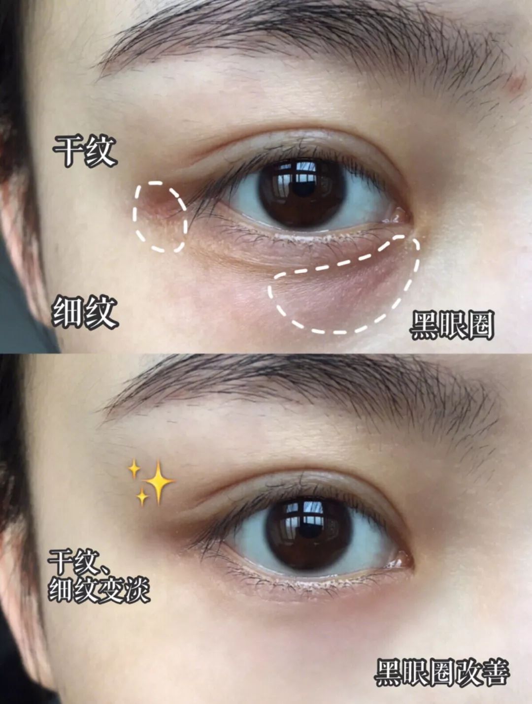 25岁必须用眼霜了吗,25岁之后适合用什么眼霜