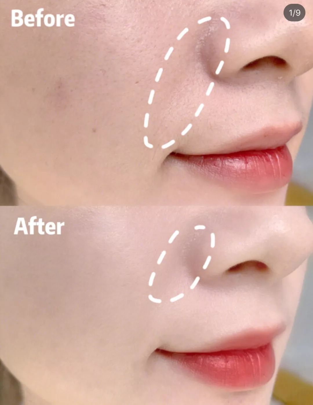 25岁必须用眼霜了吗,25岁之后适合用什么眼霜