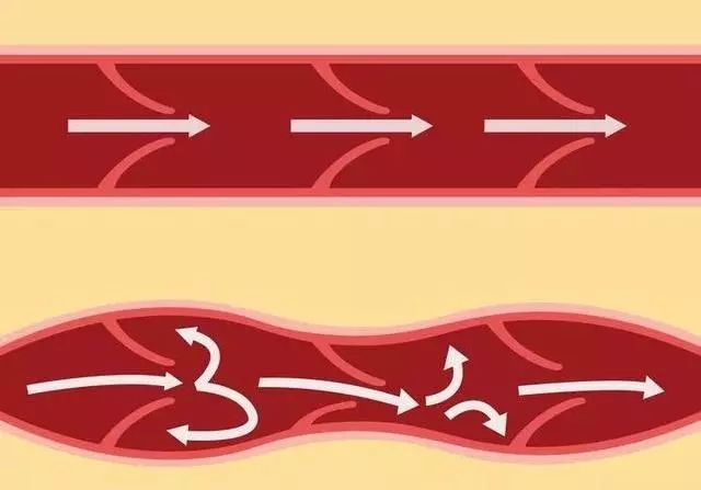 千万别乱挤痘痘一不谨慎就进了icu,挤掉痘痘后留了个洞