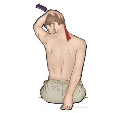 千万别乱挤痘痘一不谨慎就进了icu,挤掉痘痘后留了个洞