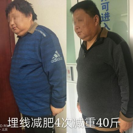 懒人减肥法两个月的时间减重70斤,减肥2个月快速瘦34斤到45斤