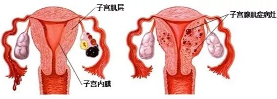 【七院名医】李田：痛经不要强忍着，排查原因很重要！
