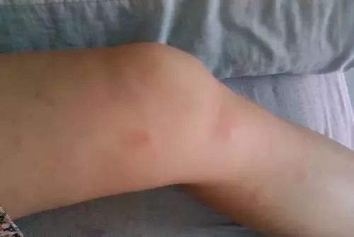 不用喂药！不用追！轻轻喷在它们的必经之路，就能瞬间“制服”！