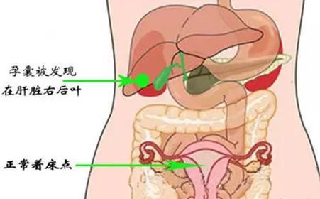 罕见骨盆畸形产妇在我院顺利产子,罕见双子宫产妇顺利产下双胞胎