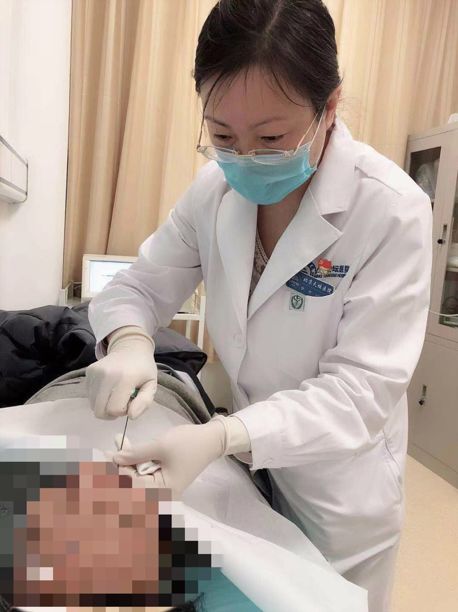 北京天坛医院三叉神经痛专家,天坛医院三叉神经手术费用