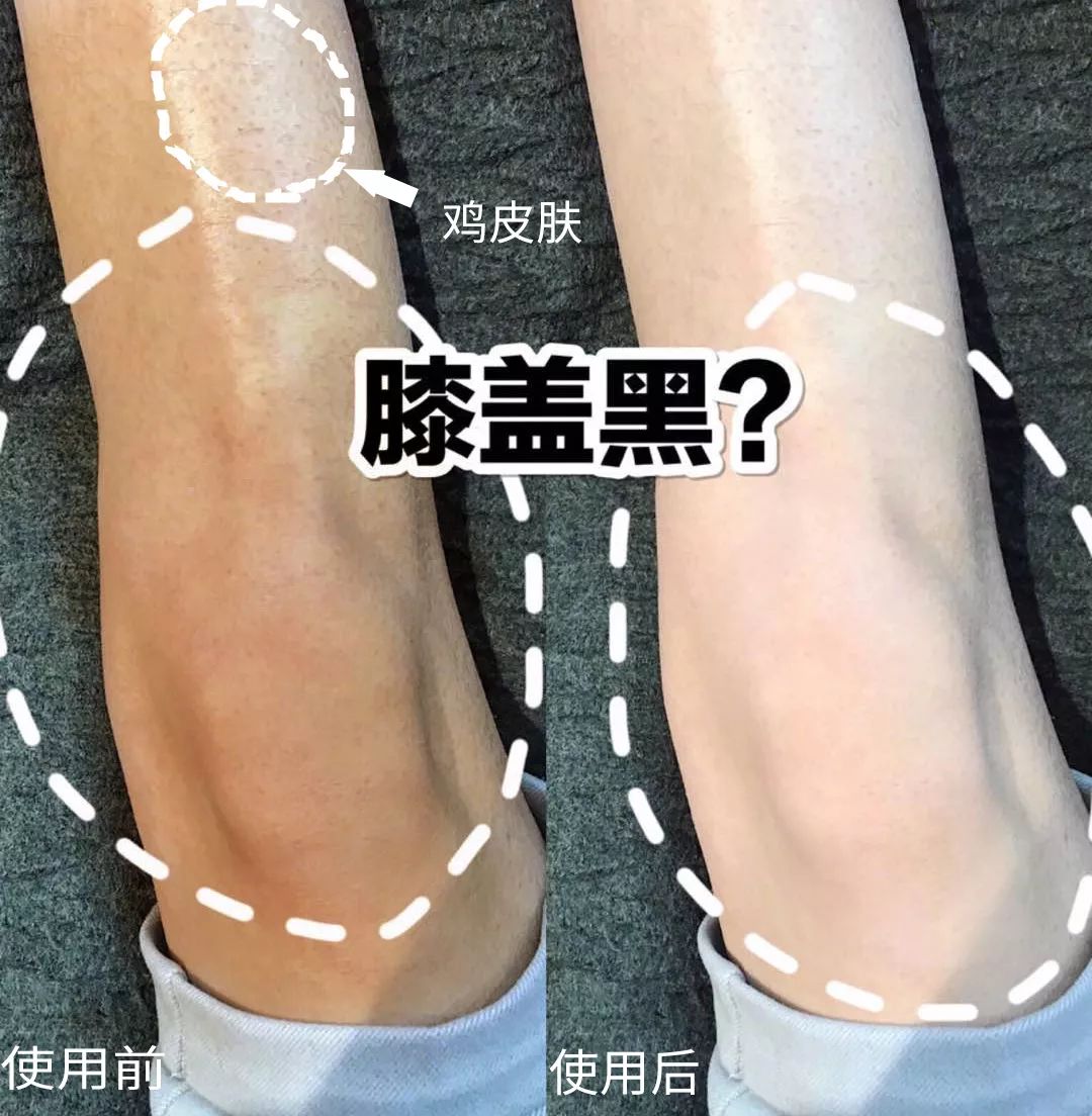 裸感美腿|1瓶=20双*袜丝**！3秒喷出“裸感”大美腿！隐形毛孔、鸡皮肤！短裙绝配