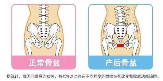 刘诗诗生过孩子后复出,刘诗诗产后怎么瘦的
