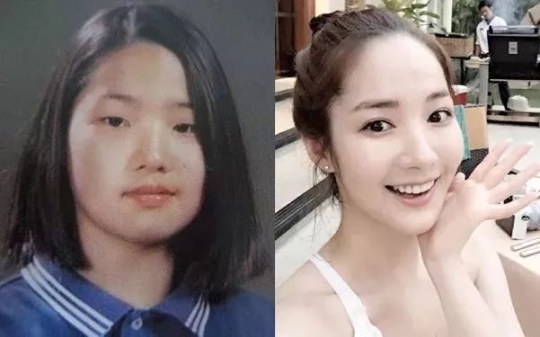 承认自己整容的韩国美女,承认整容彻底变网红脸