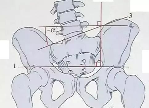 三十岁了腰就废了怎么办,28岁腰已经废了怎么办