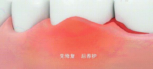 俄罗斯牙膏美白去口臭牙黄,去牙垢黄牙的牙膏测评