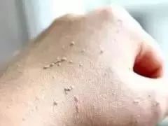 每天洗澡都能搓出泥是怎么回事,洗澡搓掉的像泥一样的东西是什么