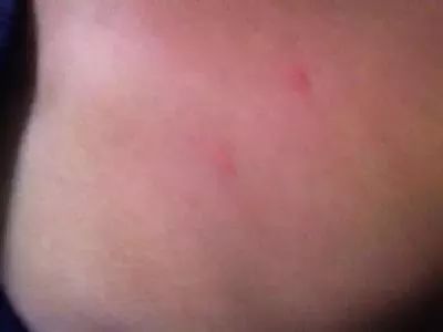 每天洗澡都能搓出泥是怎么回事,洗澡搓掉的像泥一样的东西是什么