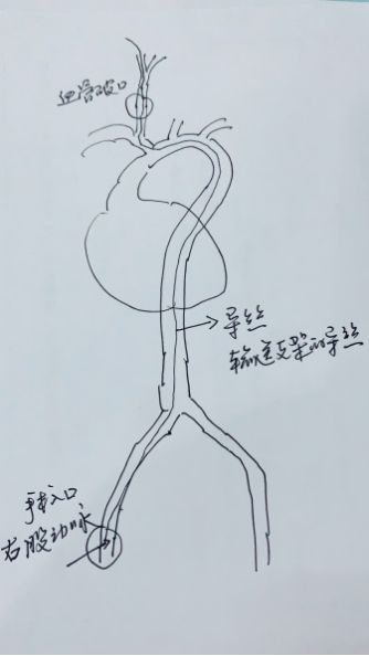 惊险男子身悬18楼外消防奋力营救,惊险浙江男子手被锯断不停喷血